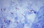 Inhaled tuberculosis vaccine more effective than traditional shot in study using experimental animals