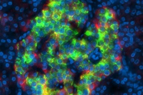 Newly discovered mechanism suggests novel approach to prevent type 1 diabetes