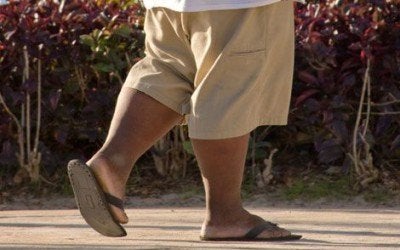 Obese man walking