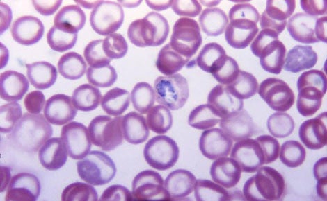Malaria cells