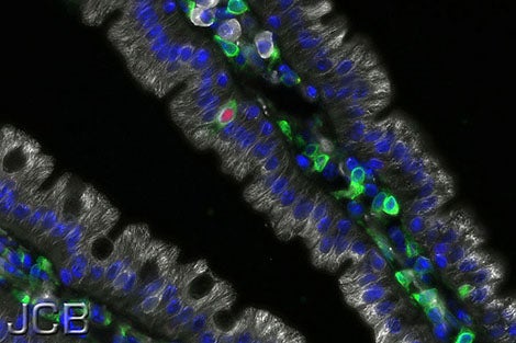 Special cells can “taste,” then help fight parasites in the gut