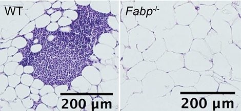Fat tissue in mice, wild type and with Fabp proteins deleted.