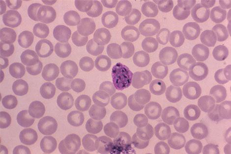 Essential doorways for malaria parasites’ invasion of red blood cells identified
