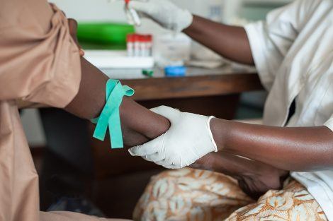 Expanded HIV testing, ART coverage increased viral suppression, decreased new HIV infections in Botswana