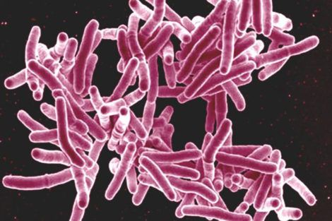 New center aims to advance research toward a vaccine for TB