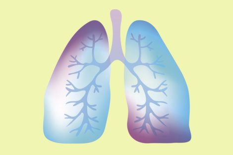 Non-allergic asthma linked with increased risk of severe COVID-19