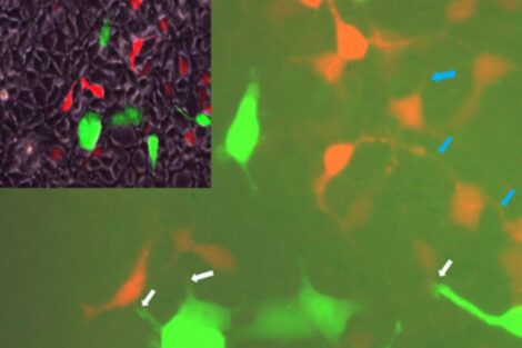 In liver, a stressed cell can be bad news for its neighbors