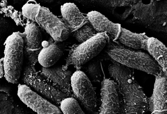 Vibrio cholerae, the bacterium that causes cholera, as seen under an electron microscope after being exposed to an antibody that Giffen was studying in 2017.