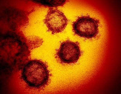 Delta-like SARS-CoV-2 variants are most likely to increase pandemic severity
