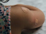 Arm of young child with band aids from vaccine