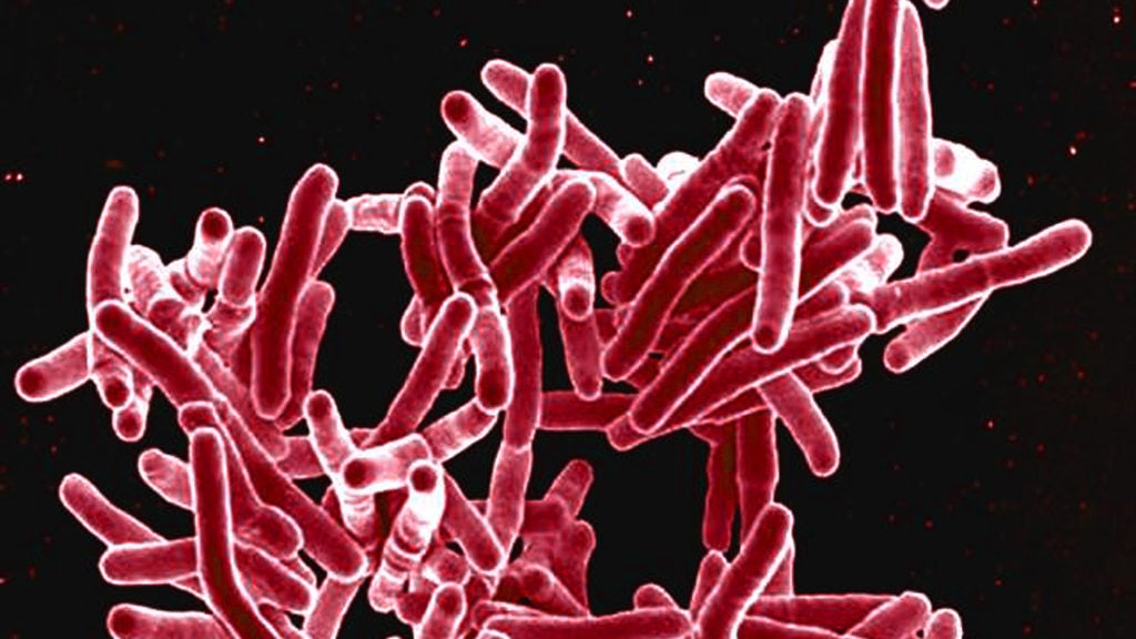 Mycobacterium tuberculosis, the bacterium that kills 1.5 million people each year.