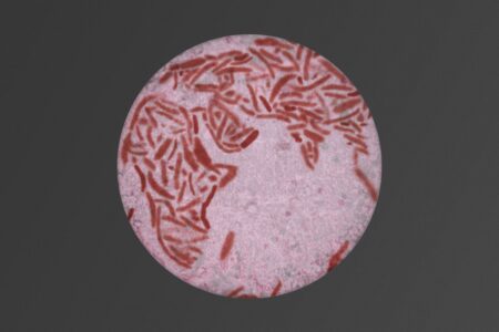 Tuberculosis bacteria on a photo of earth