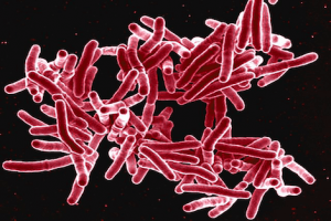 mycobacterium-tuberculosis-470x313